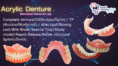 SDA/Acrylic Denture