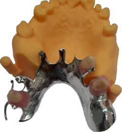 Removable Denture (RPD) Pic#2